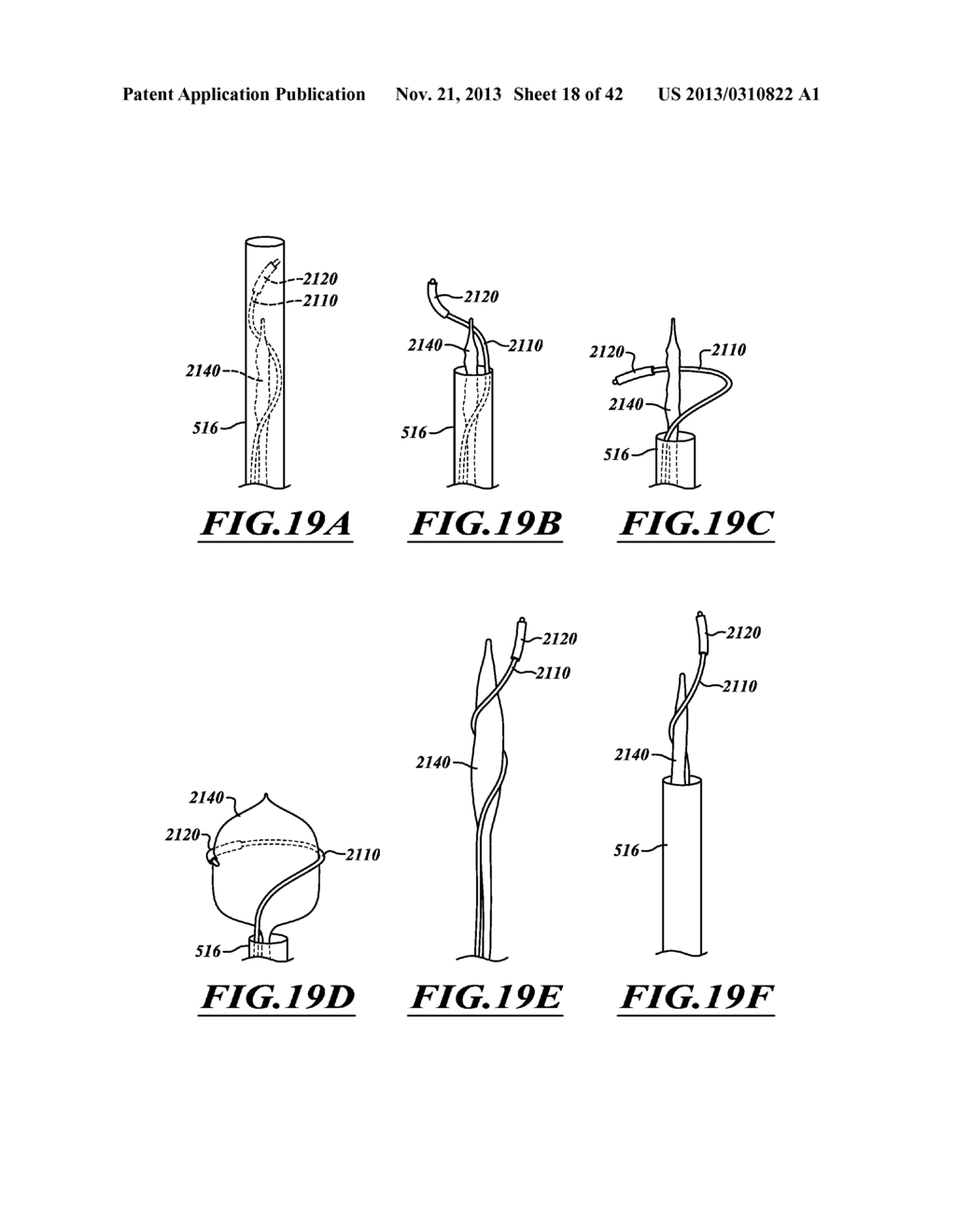 COMPACT DELIVERY PULMONARY TREATMENT SYSTEMS AND METHODS FOR IMPROVING     PULMONARY FUNCTION - diagram, schematic, and image 19