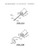 COMPACT DELIVERY PULMONARY TREATMENT SYSTEMS AND METHODS FOR IMPROVING     PULMONARY FUNCTION diagram and image