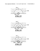 COMPACT DELIVERY PULMONARY TREATMENT SYSTEMS AND METHODS FOR IMPROVING     PULMONARY FUNCTION diagram and image