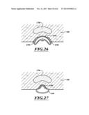 COMPACT DELIVERY PULMONARY TREATMENT SYSTEMS AND METHODS FOR IMPROVING     PULMONARY FUNCTION diagram and image