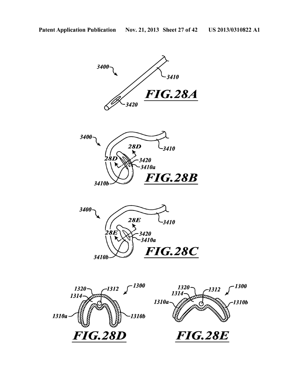 COMPACT DELIVERY PULMONARY TREATMENT SYSTEMS AND METHODS FOR IMPROVING     PULMONARY FUNCTION - diagram, schematic, and image 28