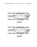 COMPACT DELIVERY PULMONARY TREATMENT SYSTEMS AND METHODS FOR IMPROVING     PULMONARY FUNCTION diagram and image