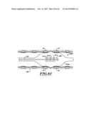 COMPACT DELIVERY PULMONARY TREATMENT SYSTEMS AND METHODS FOR IMPROVING     PULMONARY FUNCTION diagram and image