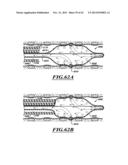 COMPACT DELIVERY PULMONARY TREATMENT SYSTEMS AND METHODS FOR IMPROVING     PULMONARY FUNCTION diagram and image