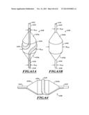 COMPACT DELIVERY PULMONARY TREATMENT SYSTEMS AND METHODS FOR IMPROVING     PULMONARY FUNCTION diagram and image