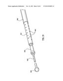 Endovascular Catheters and Methods for Carotid Body Ablation diagram and image