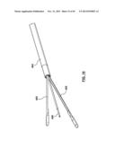 Endovascular Catheters and Methods for Carotid Body Ablation diagram and image