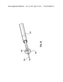 Endovascular Catheters and Methods for Carotid Body Ablation diagram and image