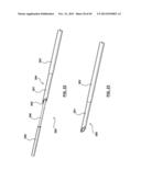 Endovascular Catheters and Methods for Carotid Body Ablation diagram and image