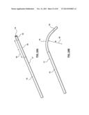 Endovascular Catheters and Methods for Carotid Body Ablation diagram and image