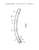 Endovascular Catheters and Methods for Carotid Body Ablation diagram and image