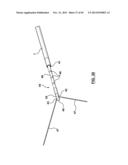 Endovascular Catheters and Methods for Carotid Body Ablation diagram and image