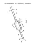 Endovascular Catheters and Methods for Carotid Body Ablation diagram and image