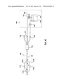 Endovascular Catheters and Methods for Carotid Body Ablation diagram and image