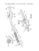 Endovascular Catheters and Methods for Carotid Body Ablation diagram and image