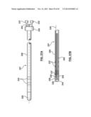 Endovascular Catheters and Methods for Carotid Body Ablation diagram and image