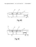 Lock Bar Spring and Clip for Implant Deployment Device diagram and image