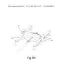 Lock Bar Spring and Clip for Implant Deployment Device diagram and image