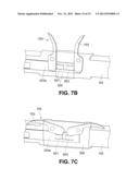Lock Bar Spring and Clip for Implant Deployment Device diagram and image