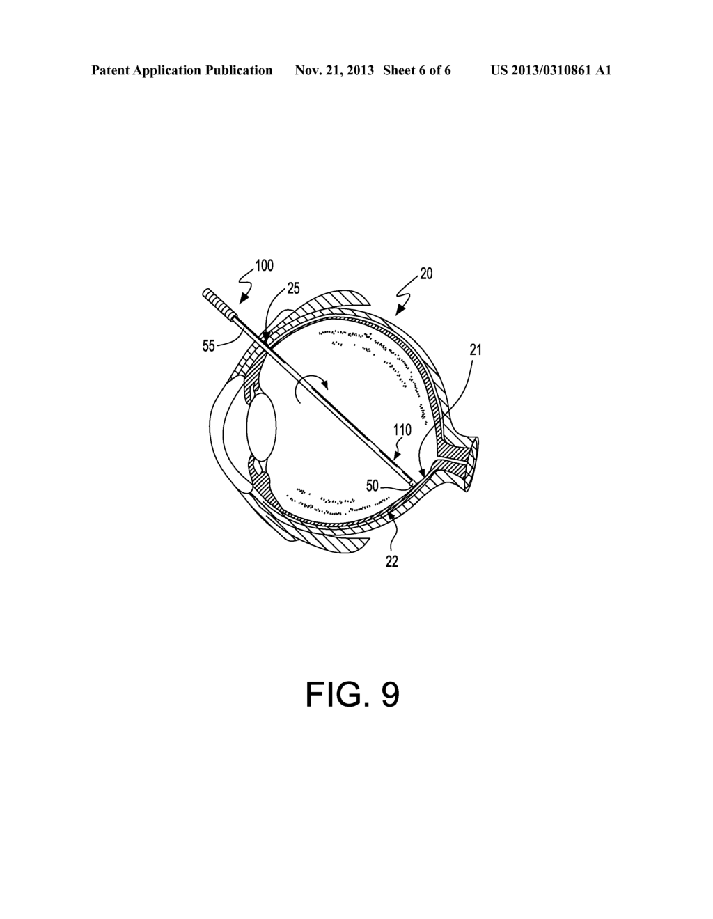 RETINAL INSTRUMENT - diagram, schematic, and image 07