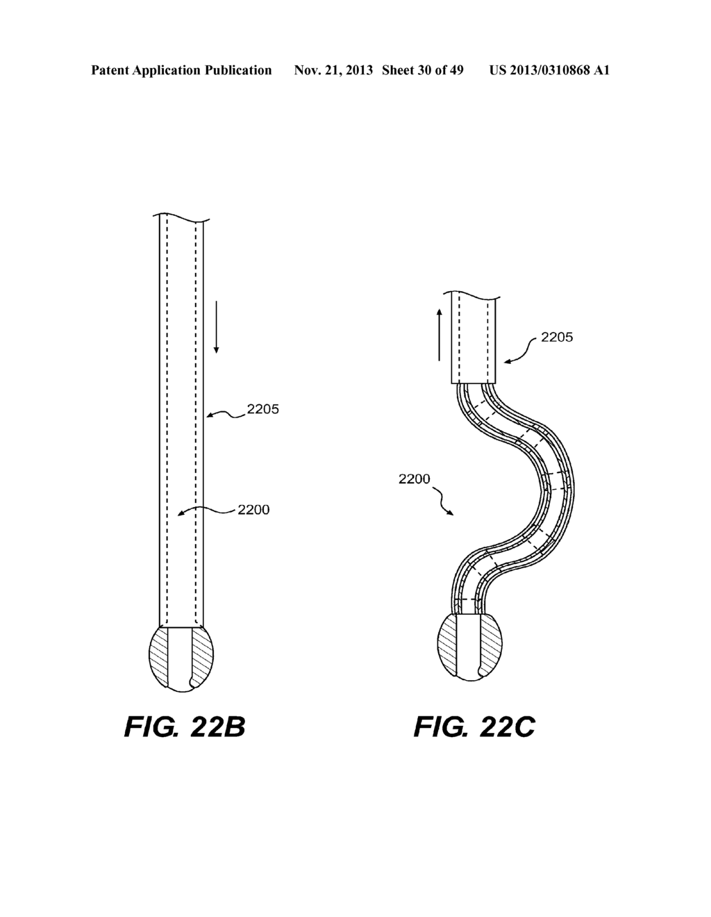 ENDOVASCULAR DEVICES AND METHODS FOR EXPLOITING INTRAMURAL SPACE - diagram, schematic, and image 31