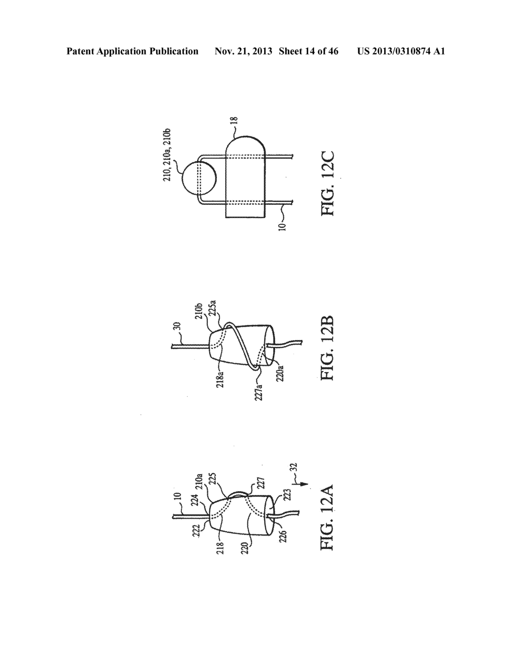 CLOSURE DEVICE AND METHOD FOR TISSUE REPAIR - diagram, schematic, and image 15