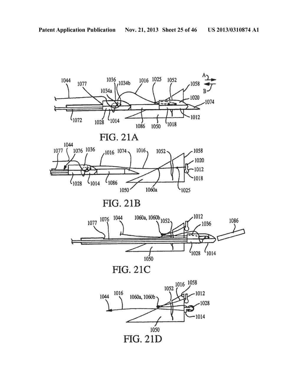 CLOSURE DEVICE AND METHOD FOR TISSUE REPAIR - diagram, schematic, and image 26