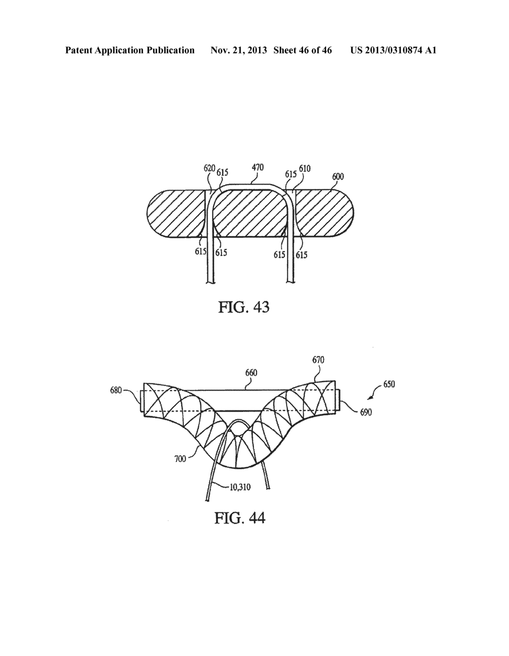 CLOSURE DEVICE AND METHOD FOR TISSUE REPAIR - diagram, schematic, and image 47