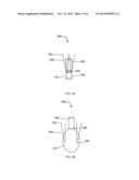 Apparatus and Methods for Attaching Soft Tissue to Bone diagram and image