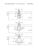 Apparatus and Methods for Attaching Soft Tissue to Bone diagram and image