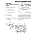 DEVICE FOR STRAIGHTENING AND STABILIZING THE VERTEBRAL COLUMN diagram and image