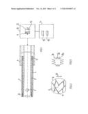 DEVICE FOR STRAIGHTENING AND STABILIZING THE VERTEBRAL COLUMN diagram and image