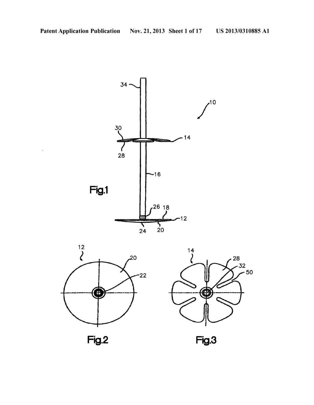 Securing Device To Secure Fixation Devices To Bone Portions - diagram, schematic, and image 02