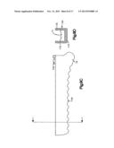 Securing Device To Secure Fixation Devices To Bone Portions diagram and image