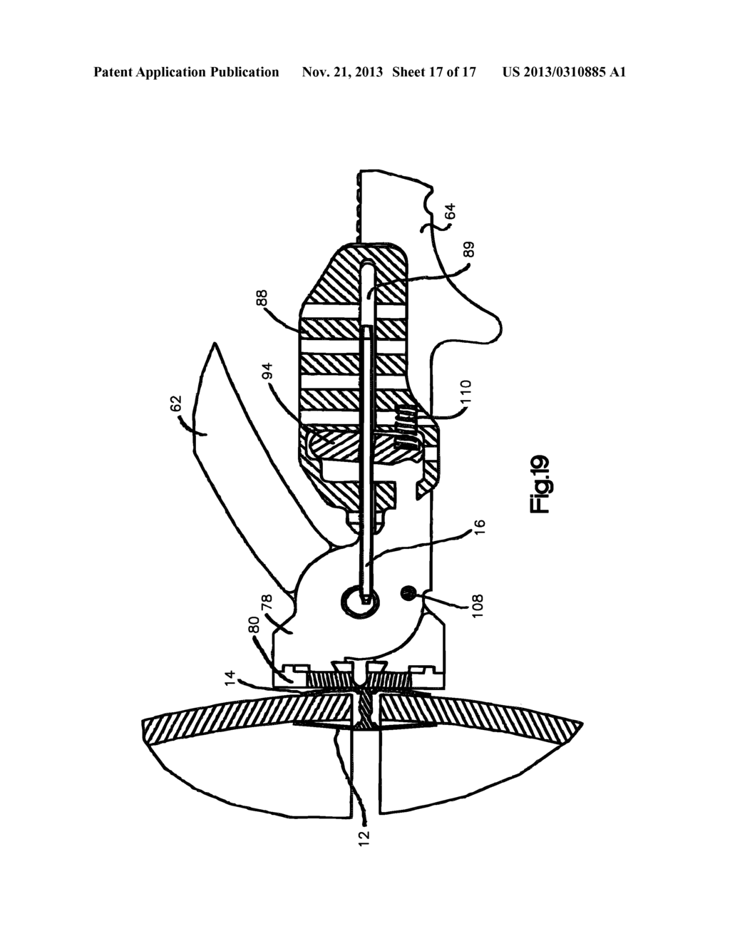 Securing Device To Secure Fixation Devices To Bone Portions - diagram, schematic, and image 18