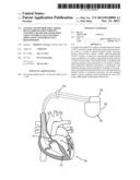 SYSTEM AND METHOD FOR CARDIAC RESYNCHRONIZATION THERAPY CONTROL PARAMETER     GENERATION USING VENTRICULAR ACTIVATION SIMULATION AND SURFACE ECG     REGISTRATION diagram and image