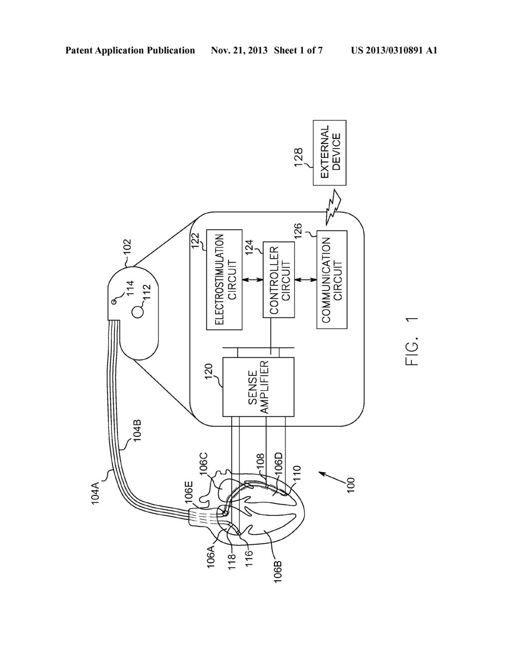 AUTOMATIC PACING CONFIGURATION SWITCHER - diagram, schematic, and image 02