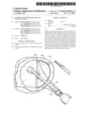 SYSTEMS AND METHODS FOR TREATING LUMENAL VALVES diagram and image