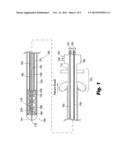 SYSTEMS AND METHODS FOR TREATING LUMENAL VALVES diagram and image