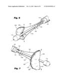 SYSTEMS AND METHODS FOR TREATING LUMENAL VALVES diagram and image