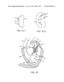 PROSTHETIC HEART VALVE DEVICES AND ASSOCIATED SYSTEMS AND METHODS diagram and image