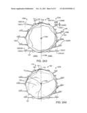 PROSTHETIC HEART VALVE DEVICES AND ASSOCIATED SYSTEMS AND METHODS diagram and image