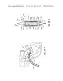 PROSTHETIC HEART VALVE DEVICES AND ASSOCIATED SYSTEMS AND METHODS diagram and image