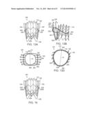 PROSTHETIC HEART VALVE DEVICES AND ASSOCIATED SYSTEMS AND METHODS diagram and image