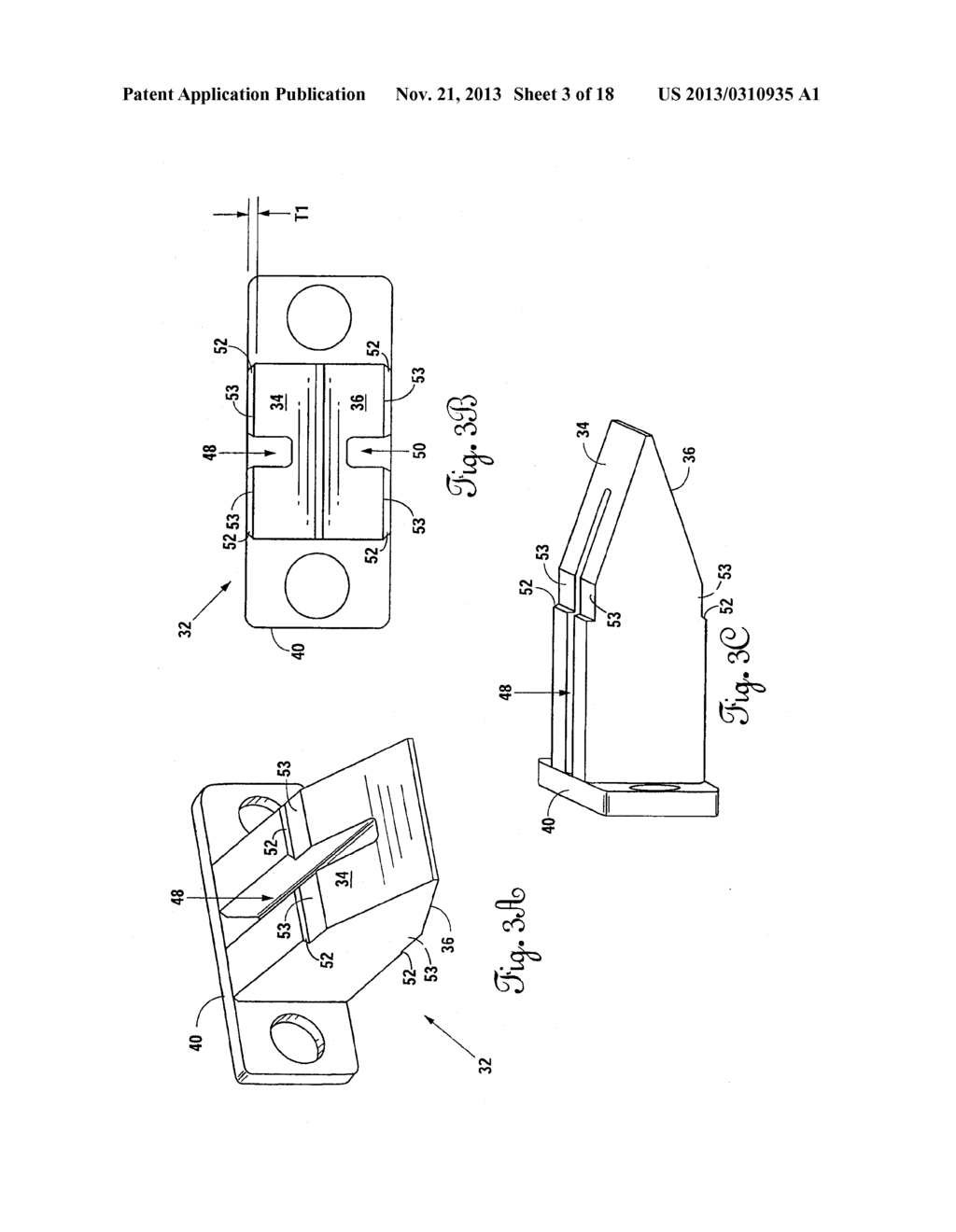 STAND-ALONE SPINAL CAGE - diagram, schematic, and image 04