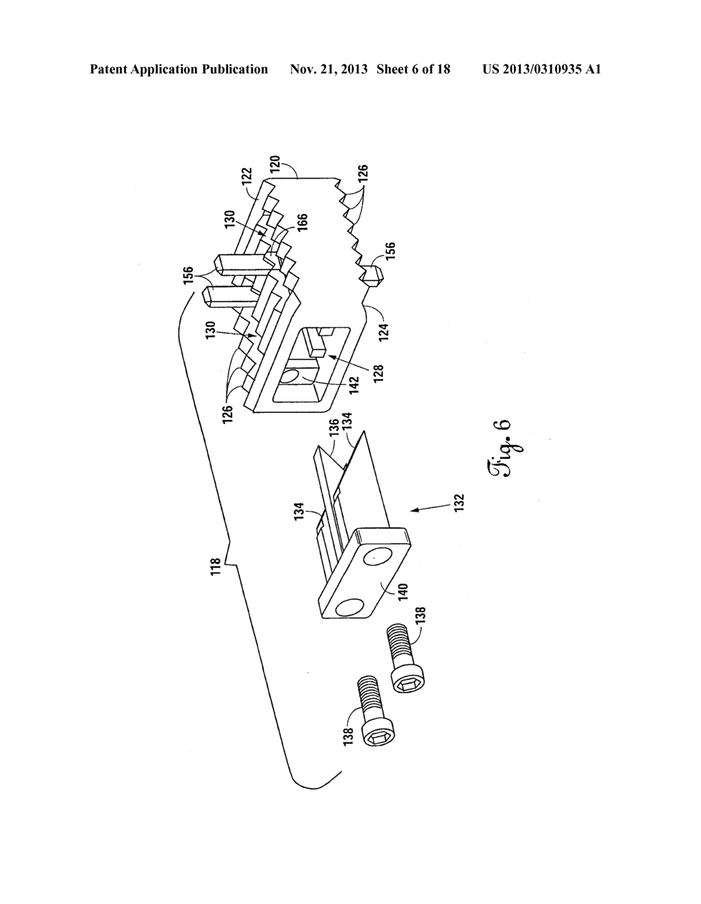 STAND-ALONE SPINAL CAGE - diagram, schematic, and image 07