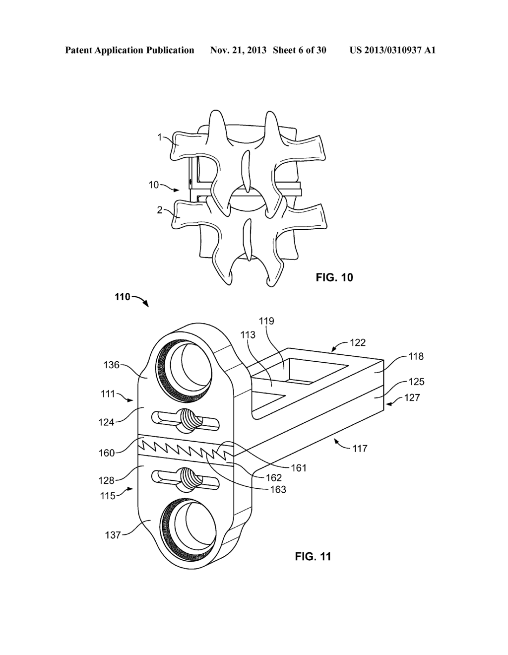 Spinal Implants for Rotationally Adjusting Vertebrae - diagram, schematic, and image 07