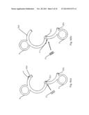 Adjustable Horse Bit diagram and image