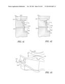 ROCKER ARM ASSEMBLY AND COMPONENTS THEREFOR diagram and image