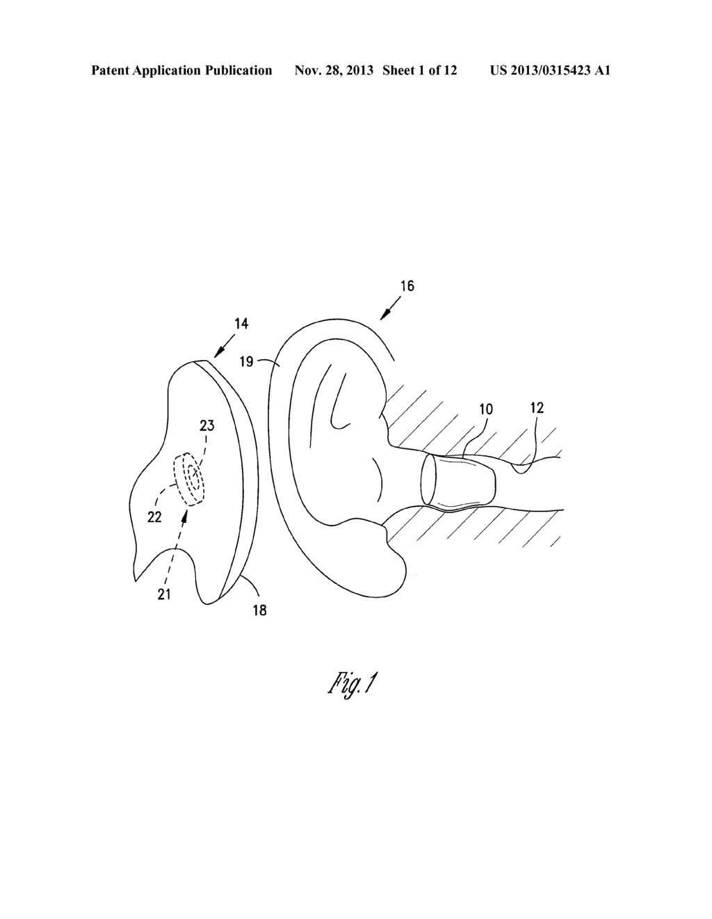 SWITCHING STRUCTURES FOR HEARING AID - diagram, schematic, and image 02